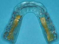 retainers